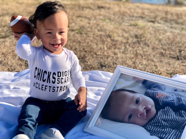 Chicks digs scares #Cleftstrong